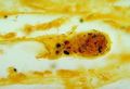 Лептоспироз (Leptospirosis)