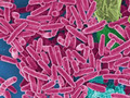 Оценка специфичности селективной питательной среды для выделения Pseudomonas aeruginosa